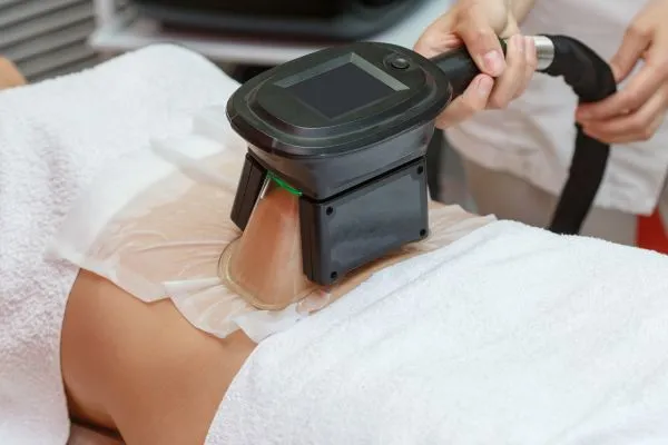 Image of person having fat freezing treatment to help weight gain Welford on Avon