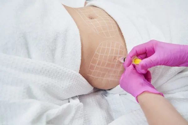 image of fat dissolving injections on love handles to help combat weight gain Welford on Avon