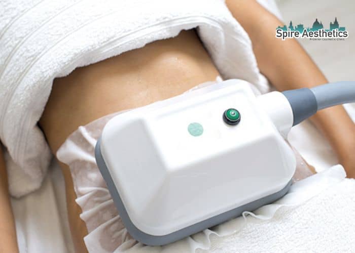 Shift Those Extra Pounds: How Fat Freezing Can Help You Slim Down Welford on Avon