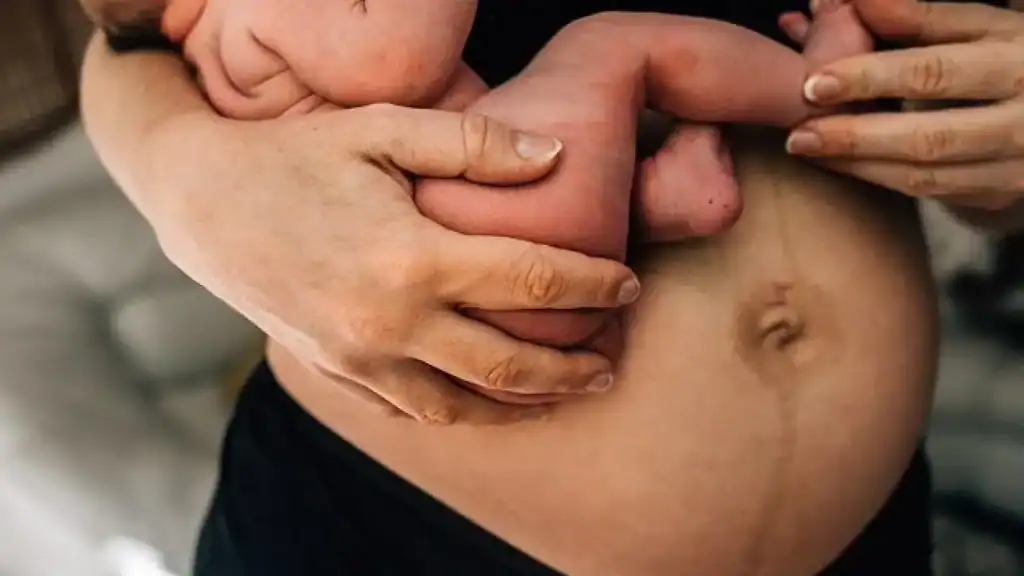 Why Is My Stomach Still Big After Pregnancy Welford on Avon?